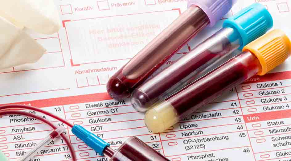 Пробирки для взятия крови на общий анализ