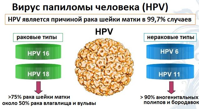 Чем опасен папилломавирус